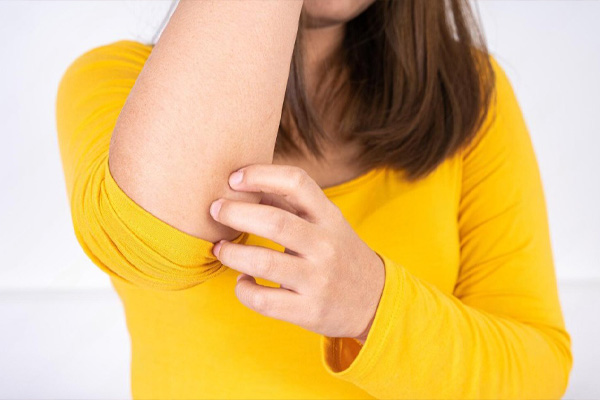 Как лечить псориаз Как лечить псориаз