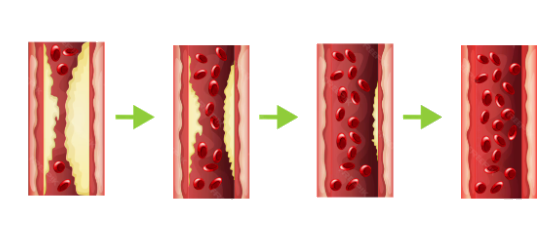 Диоскорея комплекс - для чистки сосудов