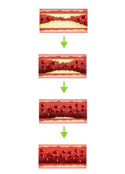 Диоскорея комплекс - для чистки сосудов